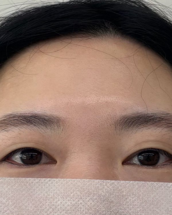 시술 전 자연눈썹
