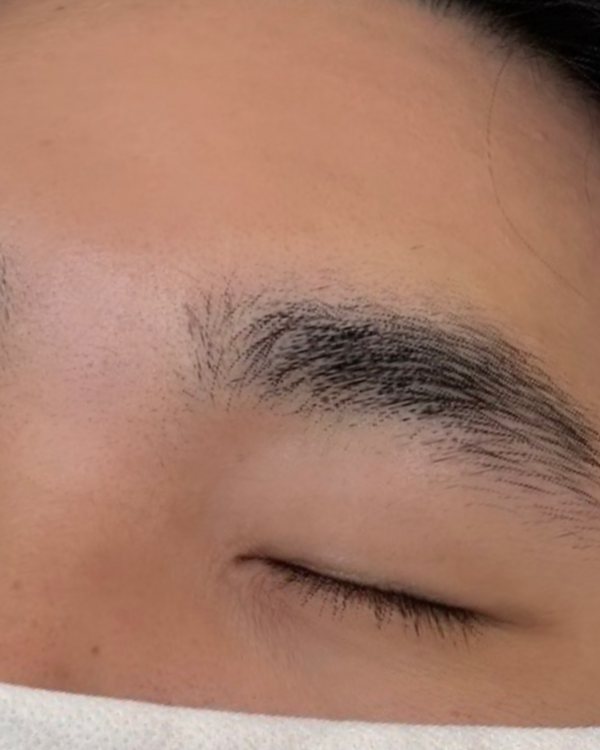 시술 전 남자눈썹