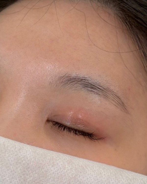 시술 전 자연눈썹