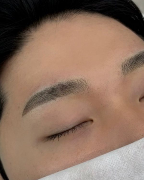 시술 후 남자눈썹
