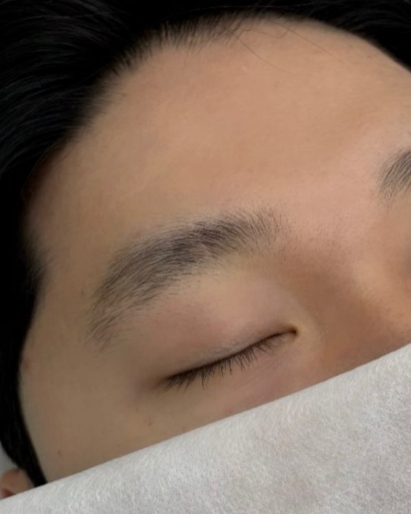 시술 전 남자눈썹